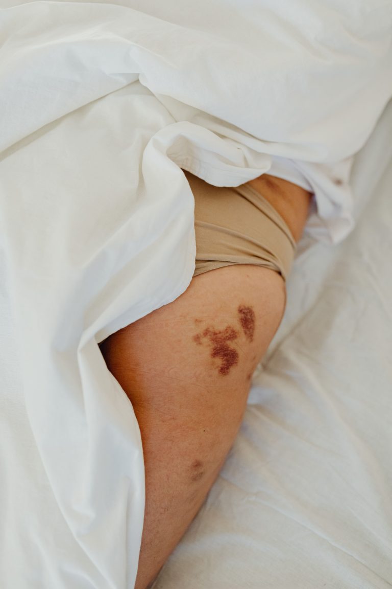 Pressure injury prevention